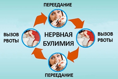 Лечение булимии в Архонской